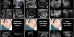 *The image is taken from Burgos-Artizzu, X.P., Coronado-Gutiérrez, D., Valenzuela-Alcaraz, B. et al. Evaluation of deep convolutional neural networks for automatic classification of common maternal fetal ultrasound planes. Sci Rep 10, 10200 (2020).